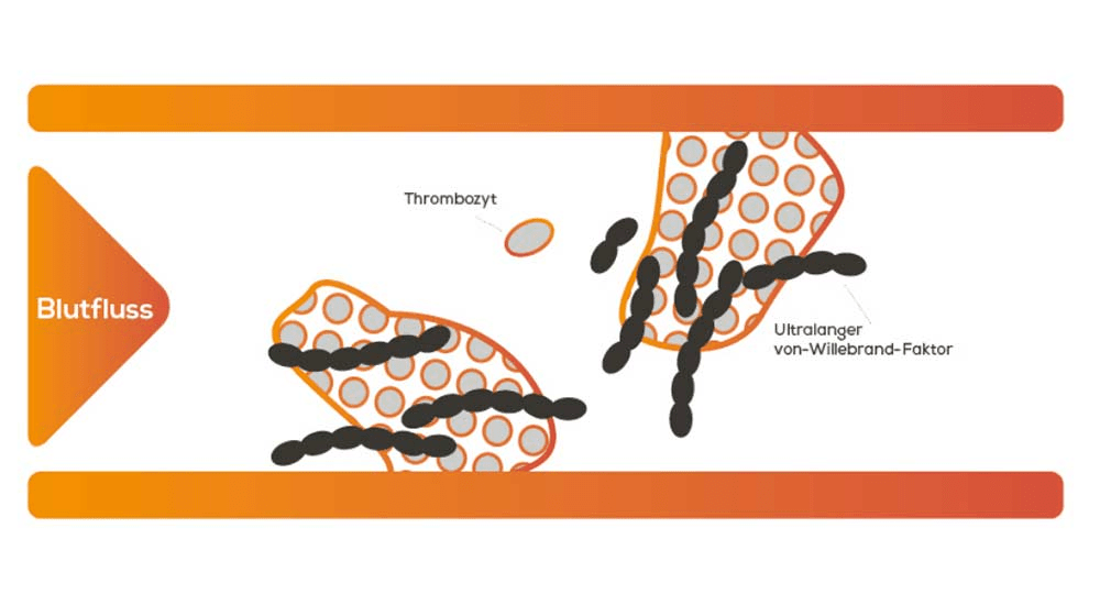 Abbildung: Blutplättchen und große vWF-Moleküle bilden Blutgerinnsel