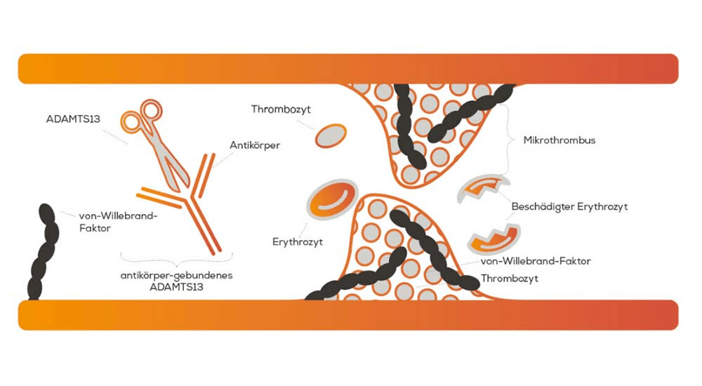 Abbildung: Das Enzym ADAMTS13 zerschneidet vWF-Moleküle in kleinere Abschnitte